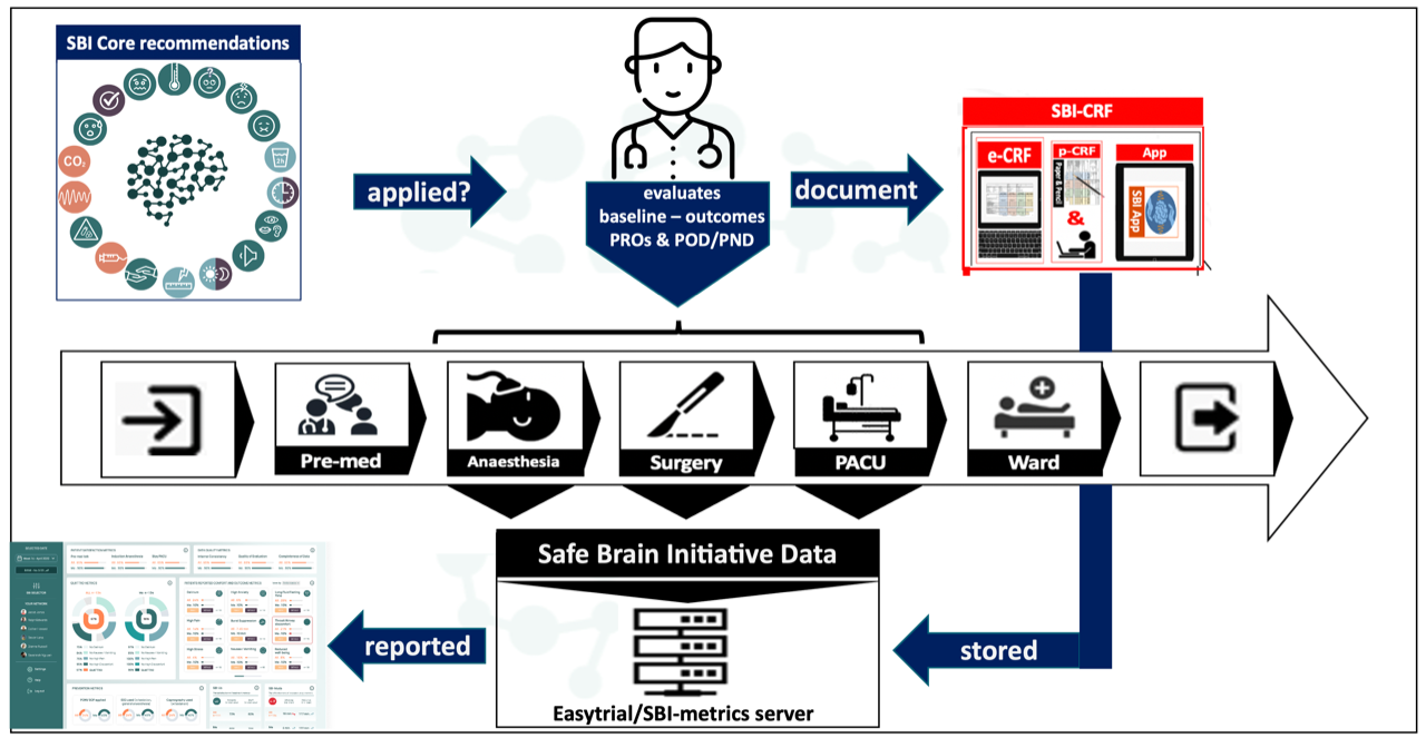SBI process diagram